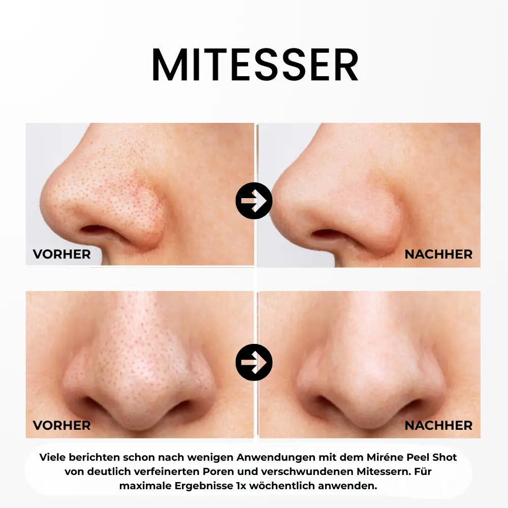 Miréne Rice Peeling - 80ml